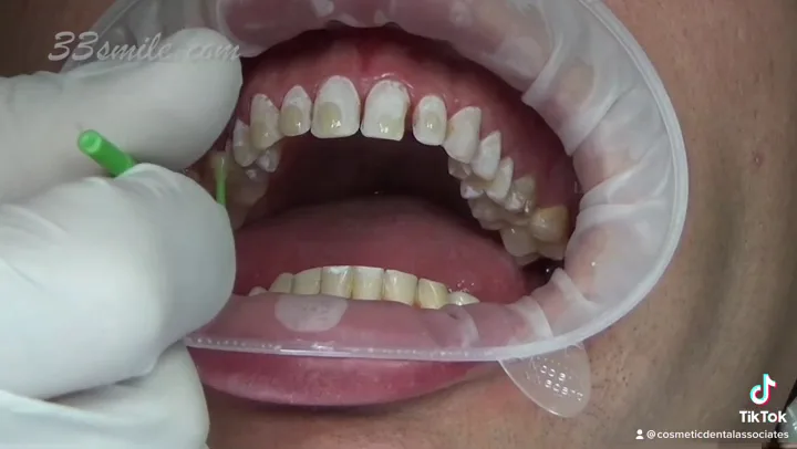 Cosmetic Dental Associates - Stone Oak — photo 3