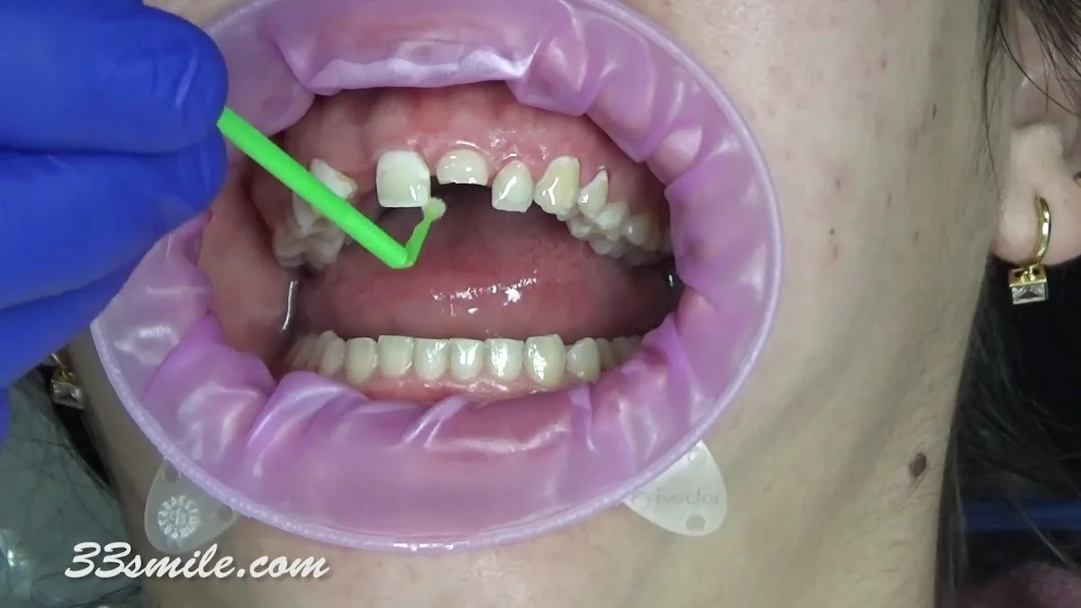 Cosmetic Dental Associates - Stone Oak — photo 5