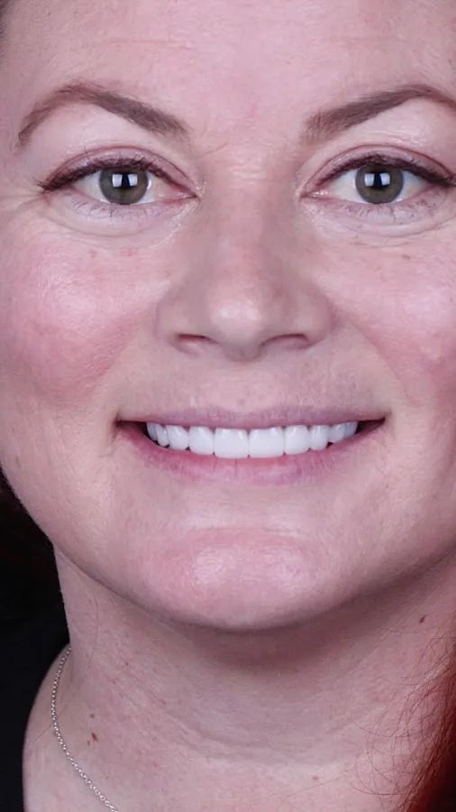 Cosmetic Dentistry of San Antonio — photo 3