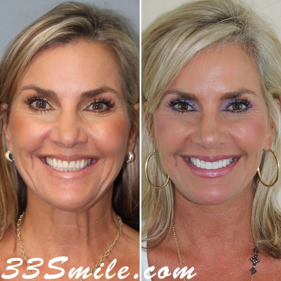 Cosmetic Dentistry of San Antonio — photo 4