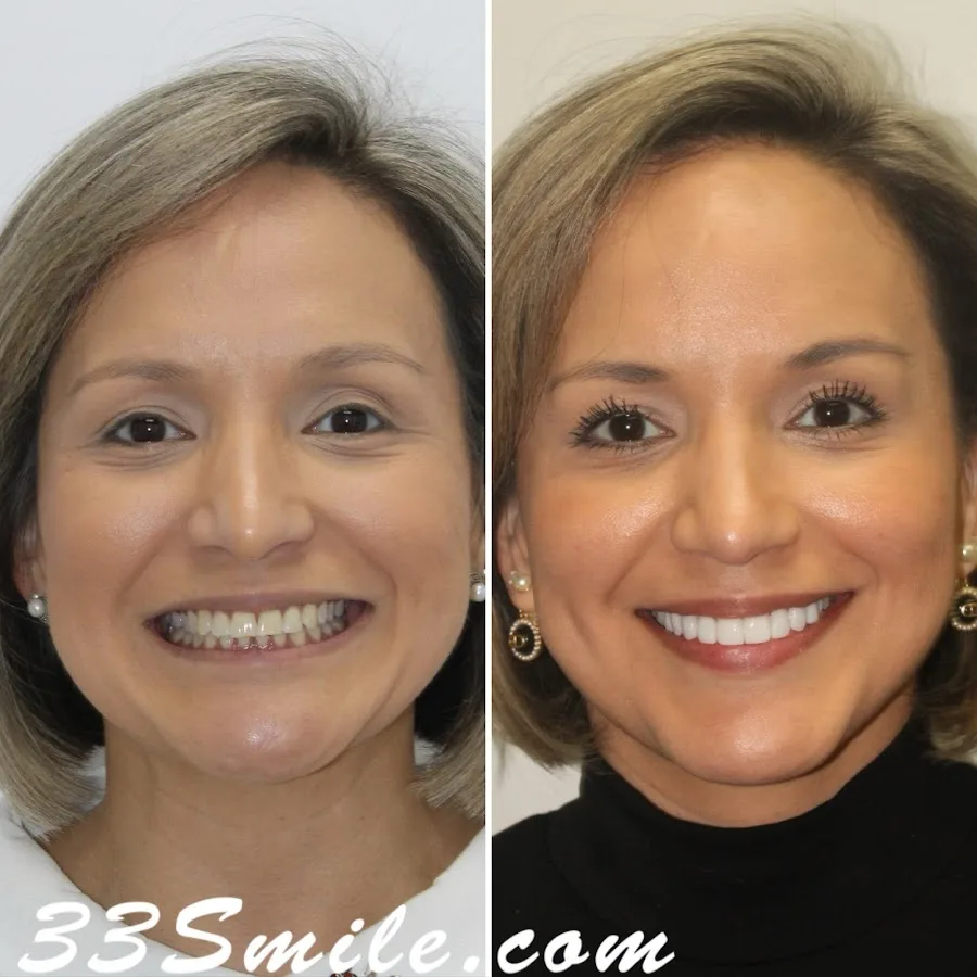 Cosmetic Dentistry of San Antonio — photo 5