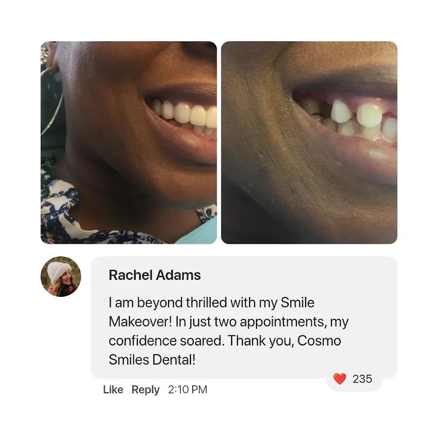 Cosmo Smiles Dental | Same Day Dental crowns | Cosmetic Dentist in Arlington VA | Crystal City — photo 2