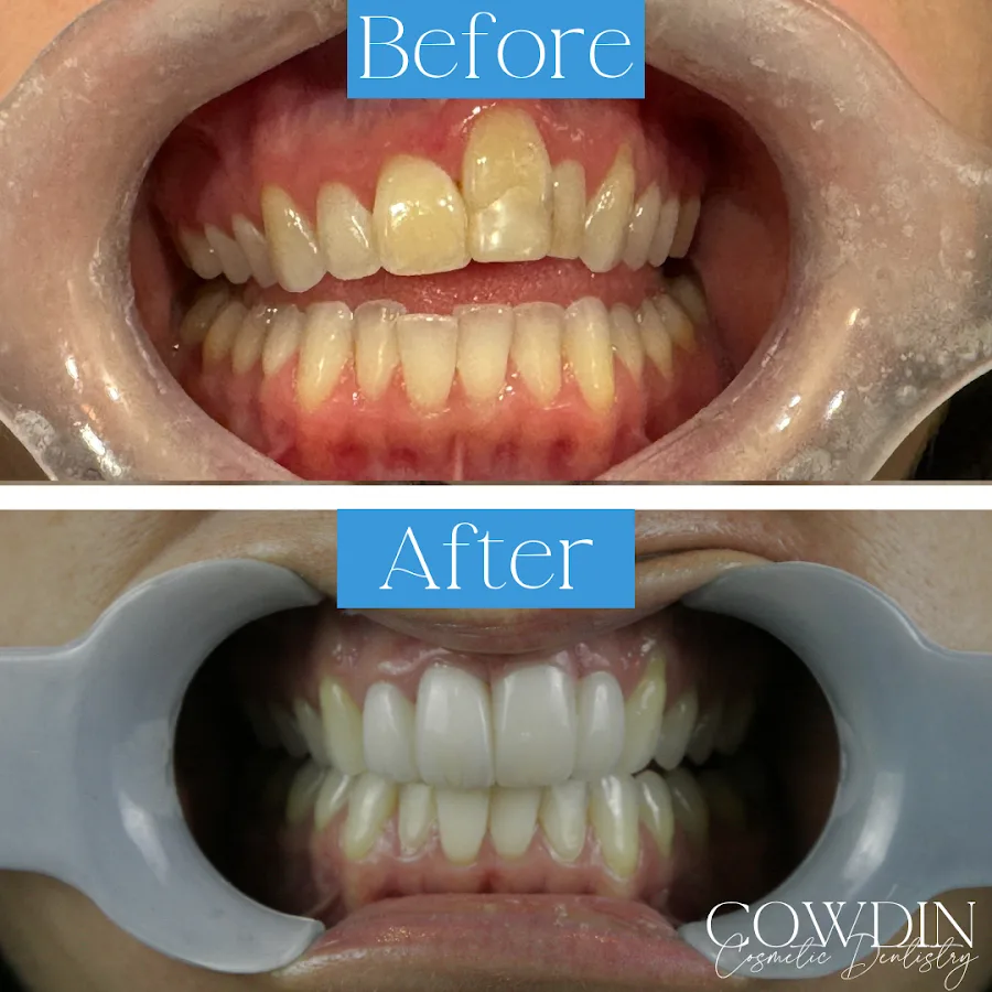 Cowdin Cosmetic Dentistry — photo 2