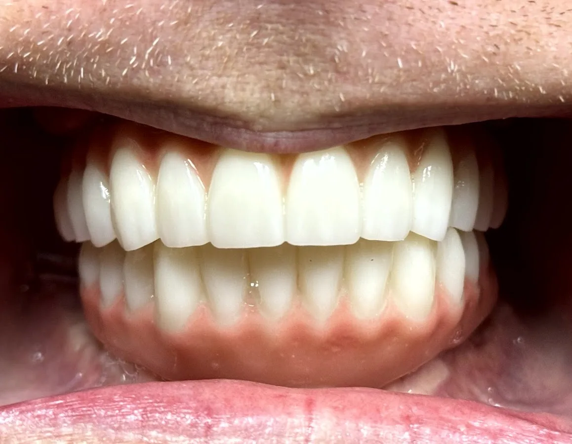 Dental, Dentures & Implants - Dr. Nathan Faber — photo 2