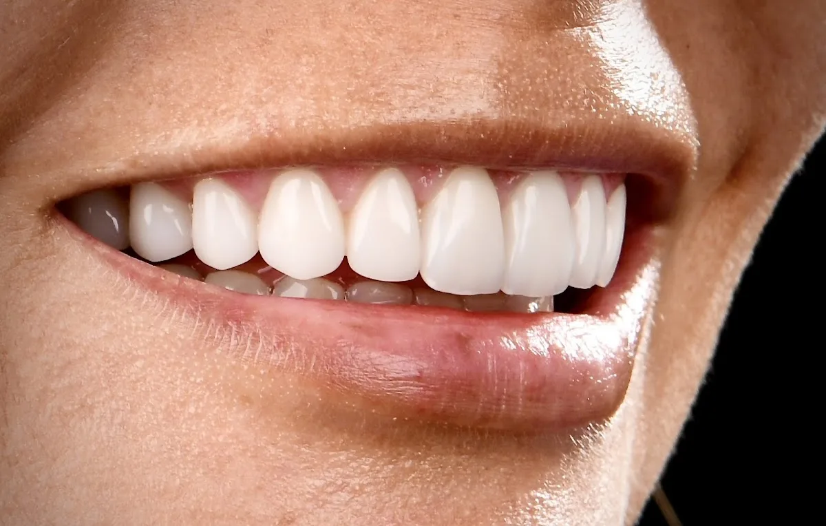 Dental Illusions — photo 3