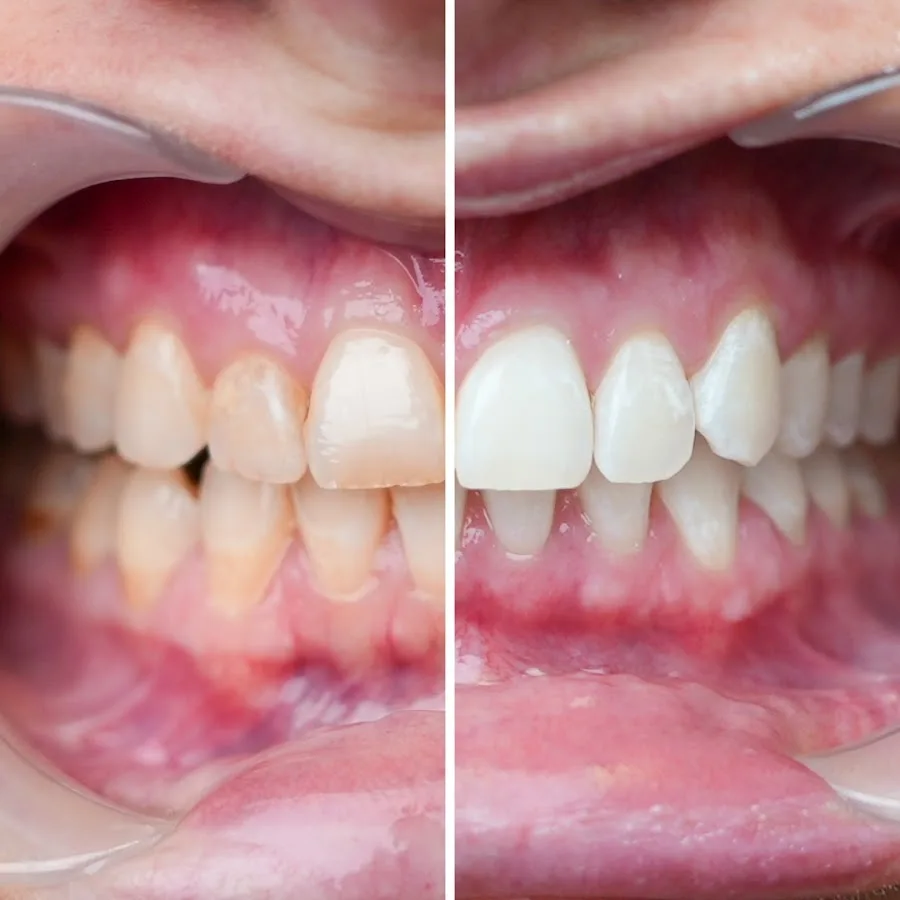 Dentist Chattanooga - Nooga Dentistry — photo 3