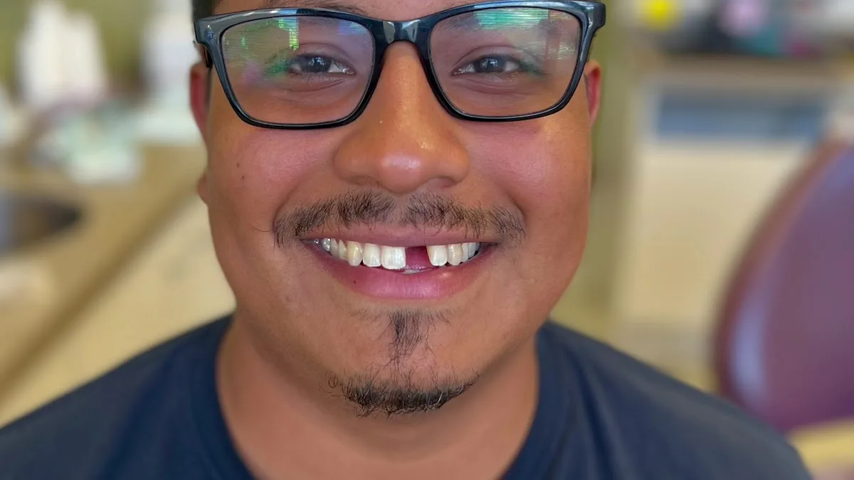 Dentist in Stamford CT - Supreme Dentist Stamford - Dental Implant Specialist and Emergency Dentist — photo 2