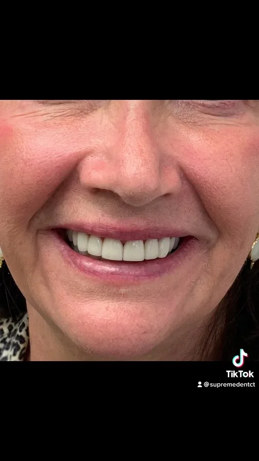 Dentist in Stamford CT - Supreme Dentist Stamford - Dental Implant Specialist and Emergency Dentist — photo 3