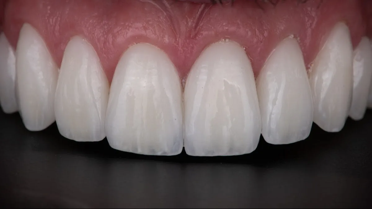 Dentistry of Nashville — photo 5