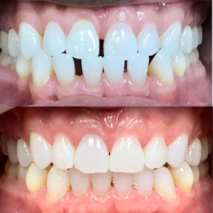 Desert Smiles Cosmetic & Restorative Dentistry — photo 5