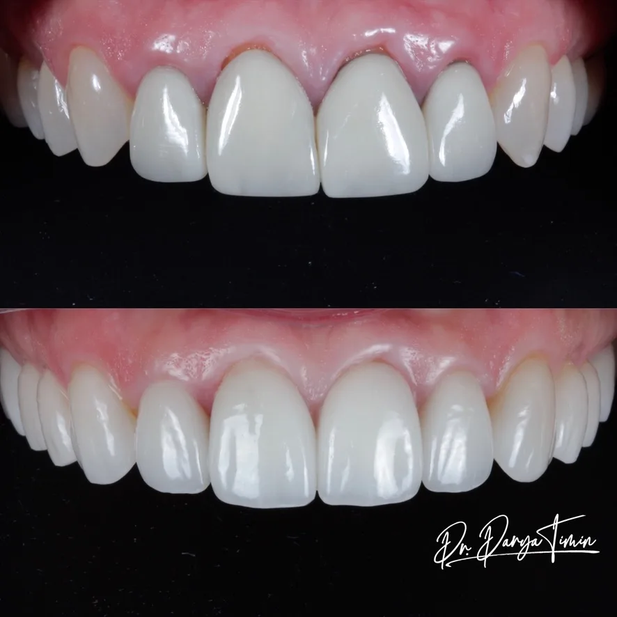 DNA Dental of Dallas: Darya Timin DDS — photo 3