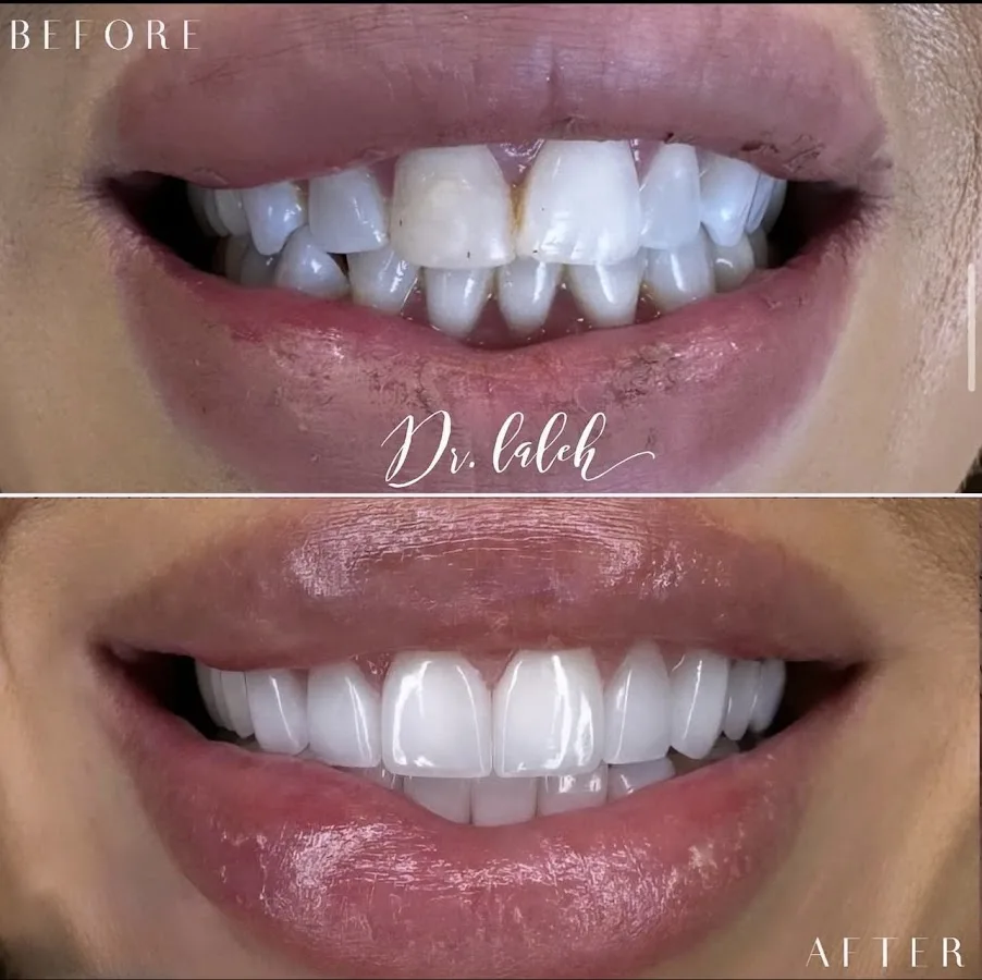 Doctor Laleh Dental Aesthetics- Dr. Laleh Mehrrafiee DDS — photo 2