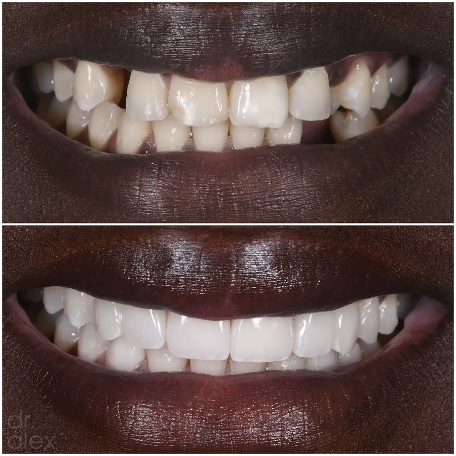 Dr. Alex Rubinov - NYC Cosmetic Dentist — photo 2