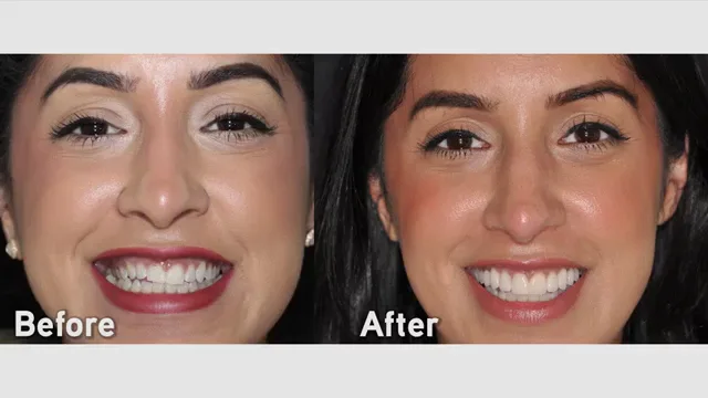 Dr. Alex Rubinov - NYC Cosmetic Dentist — photo 5