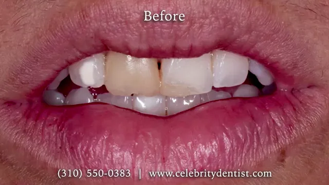 Dr. Anthony Mobasser - Celebrity Dentist — photo 4