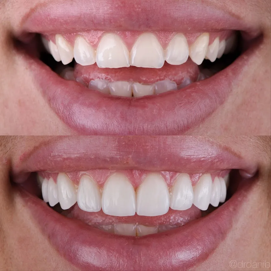 Dr. Dani Benyaminy, DDS