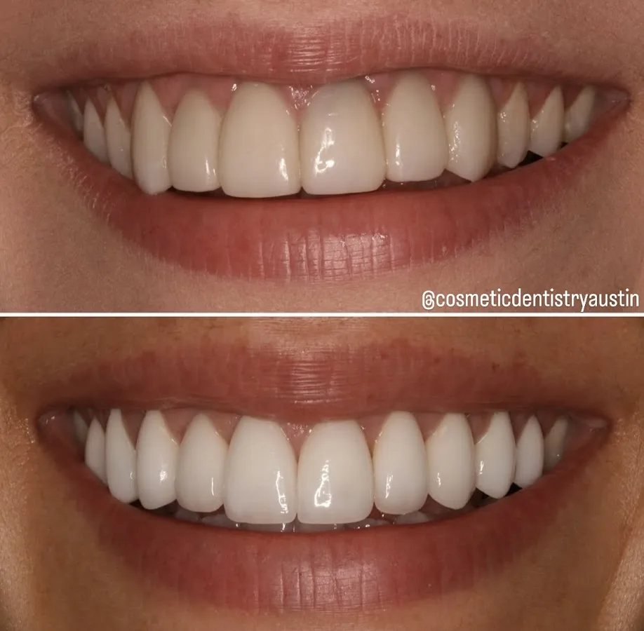 Dr. John Schmid, D.D.S. LVIF - Contemporary Cosmetic Dentistry — photo 4