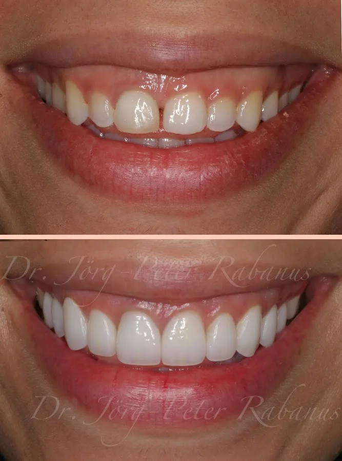 Dr. Jorg-Peter Rabanus, DDS