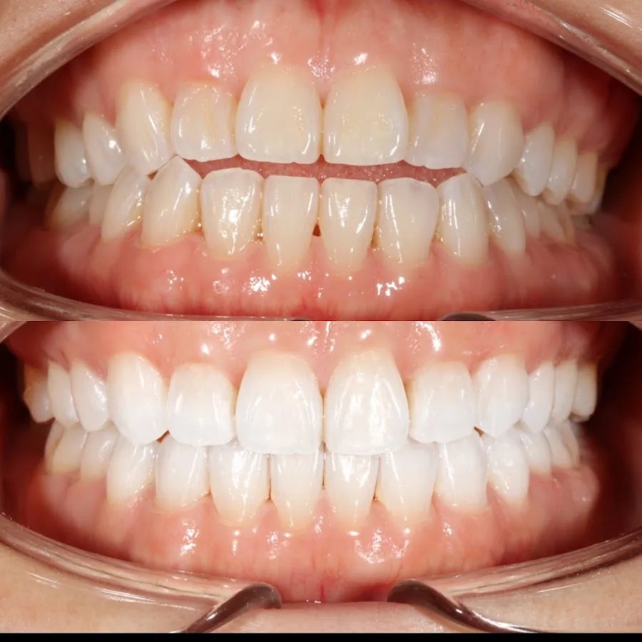 Dr. Joseph, DDS - General and Cosmetic Dentist and Dental Office, Dentistry of San Francisco — photo 2