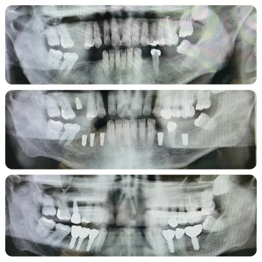 Dr. Nivedita Nijhawan, DDS - Fresno Dentist — photo 2