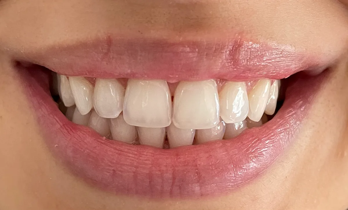 Dr. Patty Miami Cosmetic Dentistry — photo 4