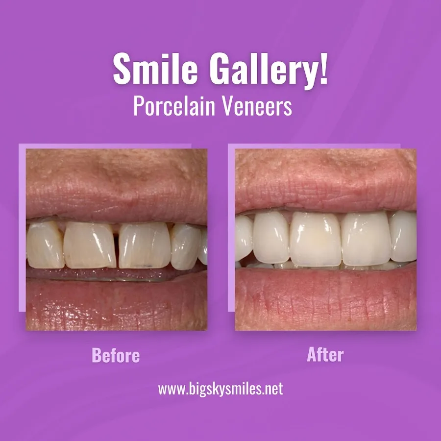 Dr. Spencer Zaugg, Family & Implant Dentistry — photo 4