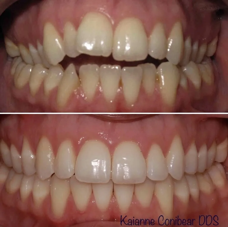 Elegantly Dental of Sand Lake — photo 4