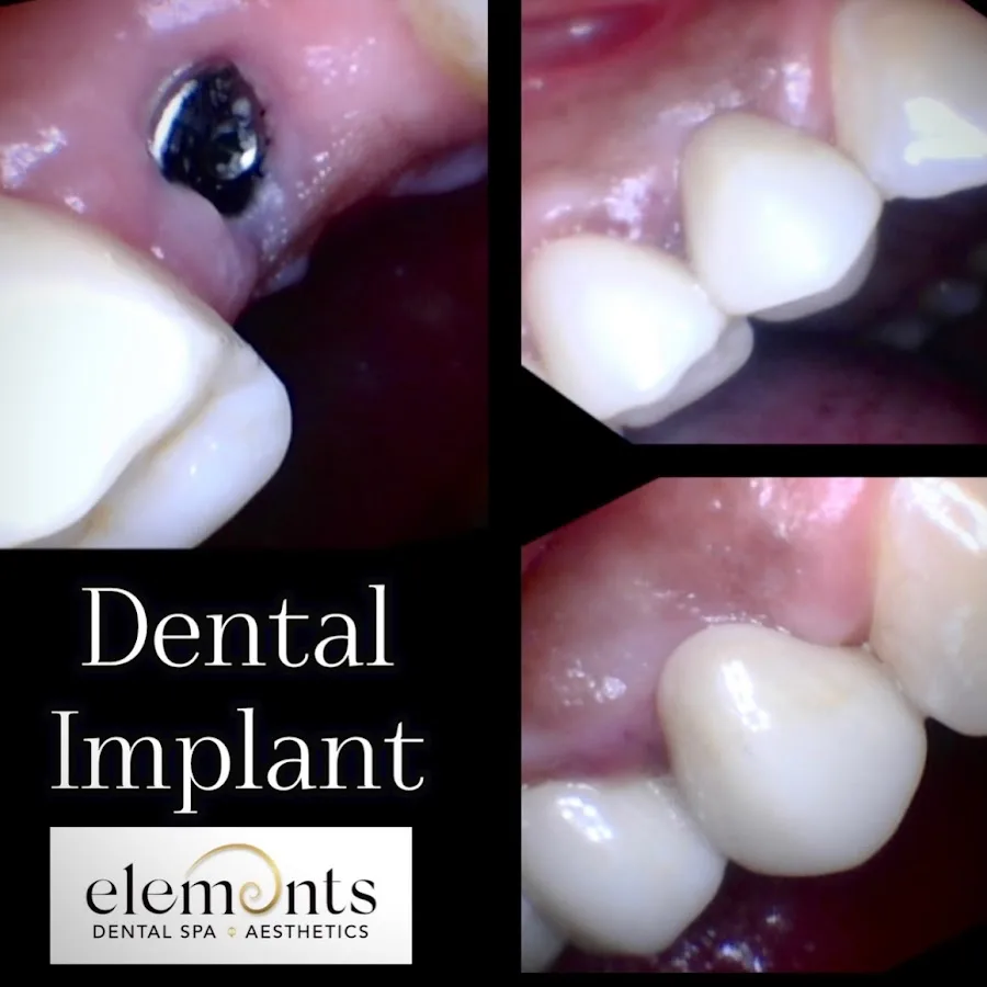 Elements Dental Spa & Aesthetics: Baton Rouge Dentist & Aesthetic Spa — photo 2