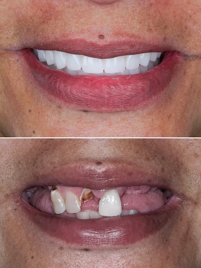 Eleve Dental Cosmetic & Implant Center