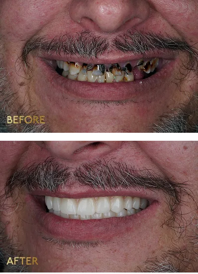 Eleve Dental Cosmetic & Implant Center — photo 2