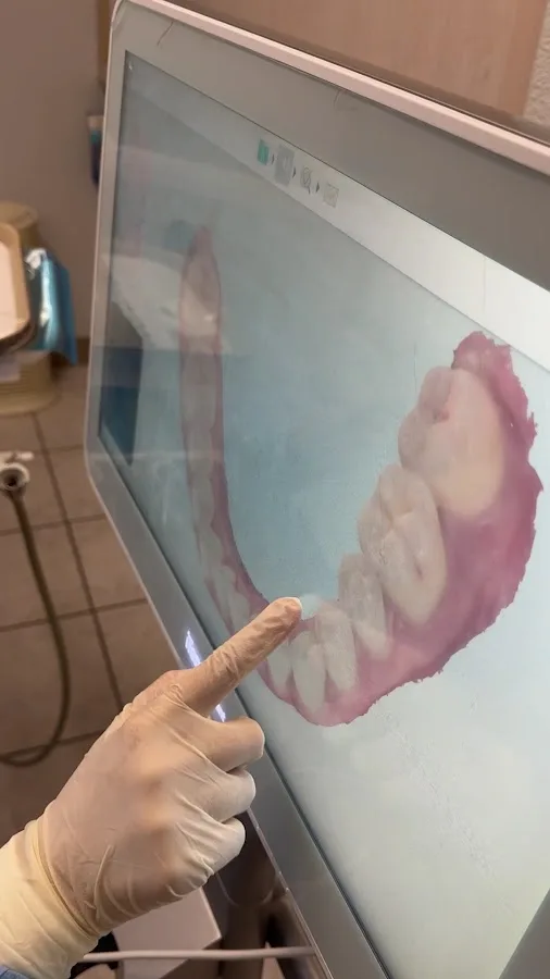 Elite Dental Irvine — photo 3