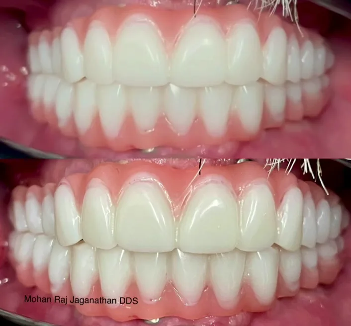 Elite Dental - Mohan Raj Jaganathan DDS & Veena Raja DDS PhD — photo 3