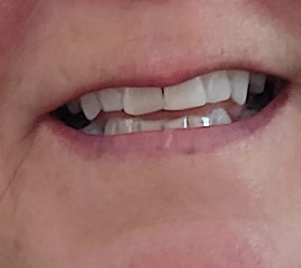 Elite Smiles of Louisville — photo 2