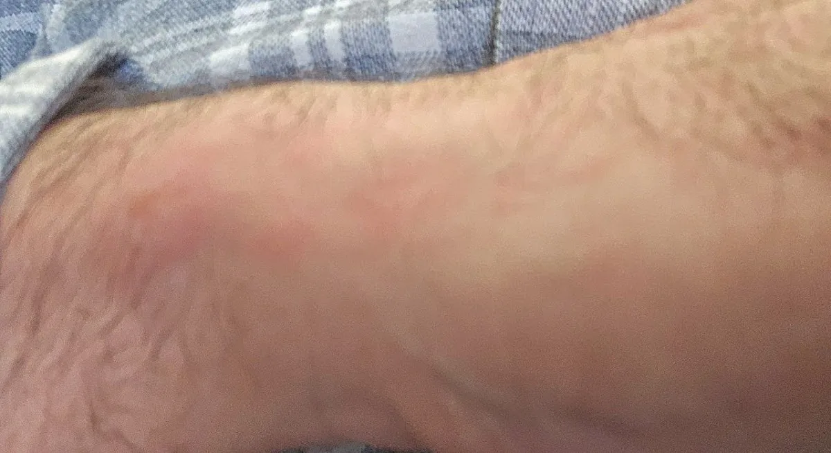 Emergency Dentist Des Moines — photo 2