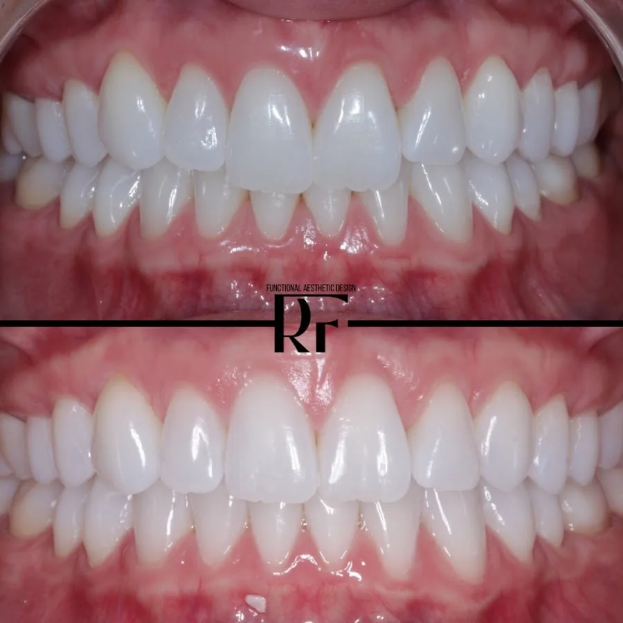 Espire Dental Mission Valley — photo 2