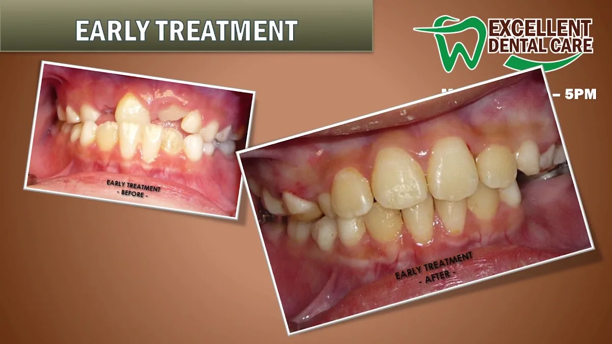 Excellent Dental Care Center — photo 2