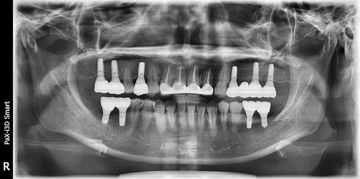 Finesse Dental & Implant Center of Boston — photo 2