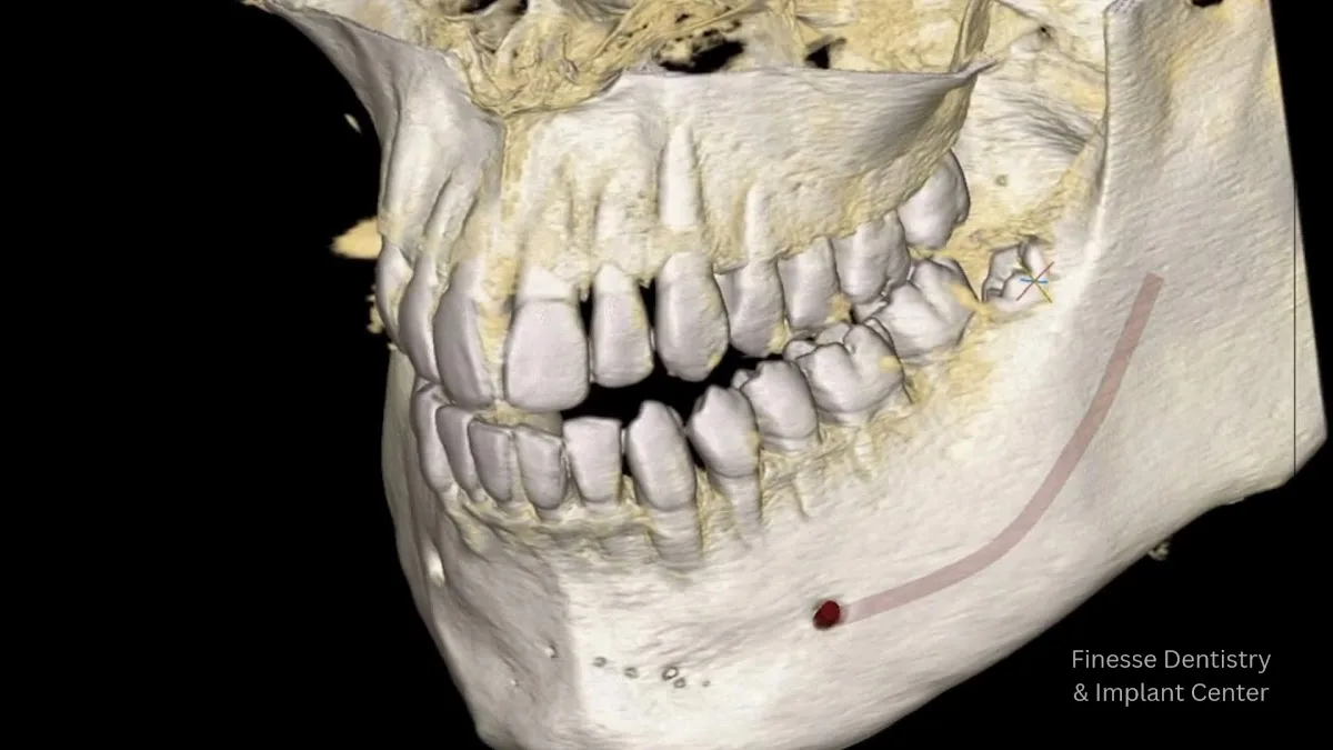 Finesse Dental & Implant Center of Boston — photo 3