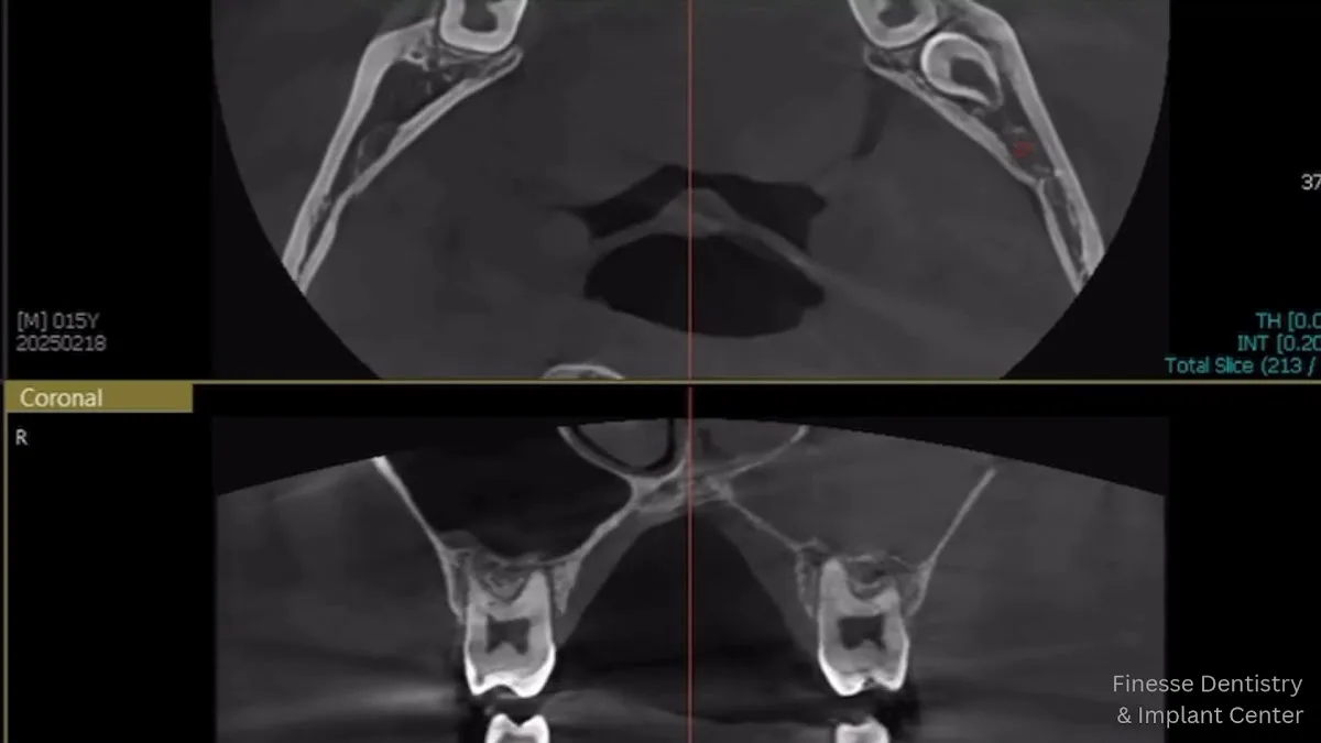 Finesse Dental & Implant Center of Boston — photo 4