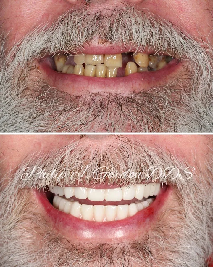 Gordon Dental Implants and Cosmetics — photo 2