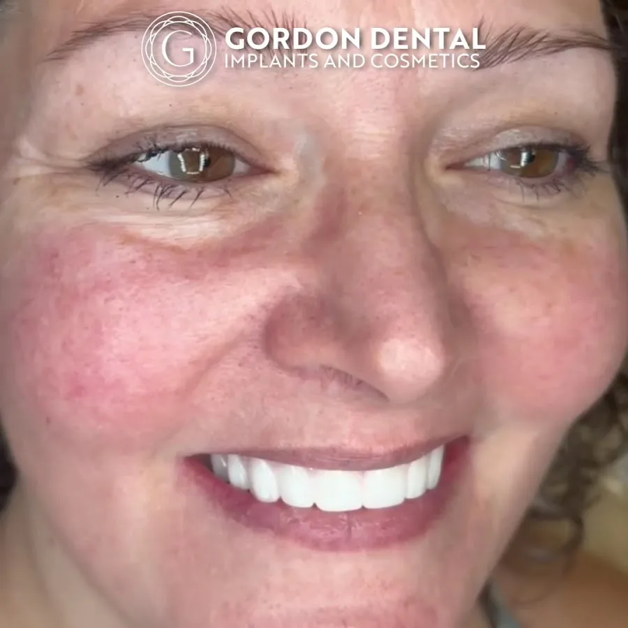 Gordon Dental Implants and Cosmetics — photo 3