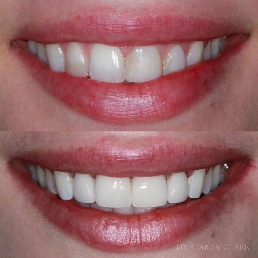 Gulch Dental Studio — photo 5