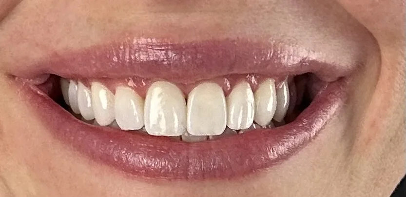 HARA Cosmetic Dentistry — photo 2