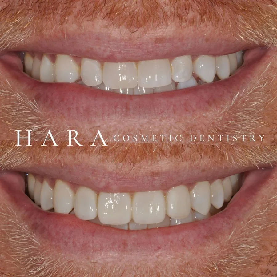 HARA Cosmetic Dentistry — photo 3