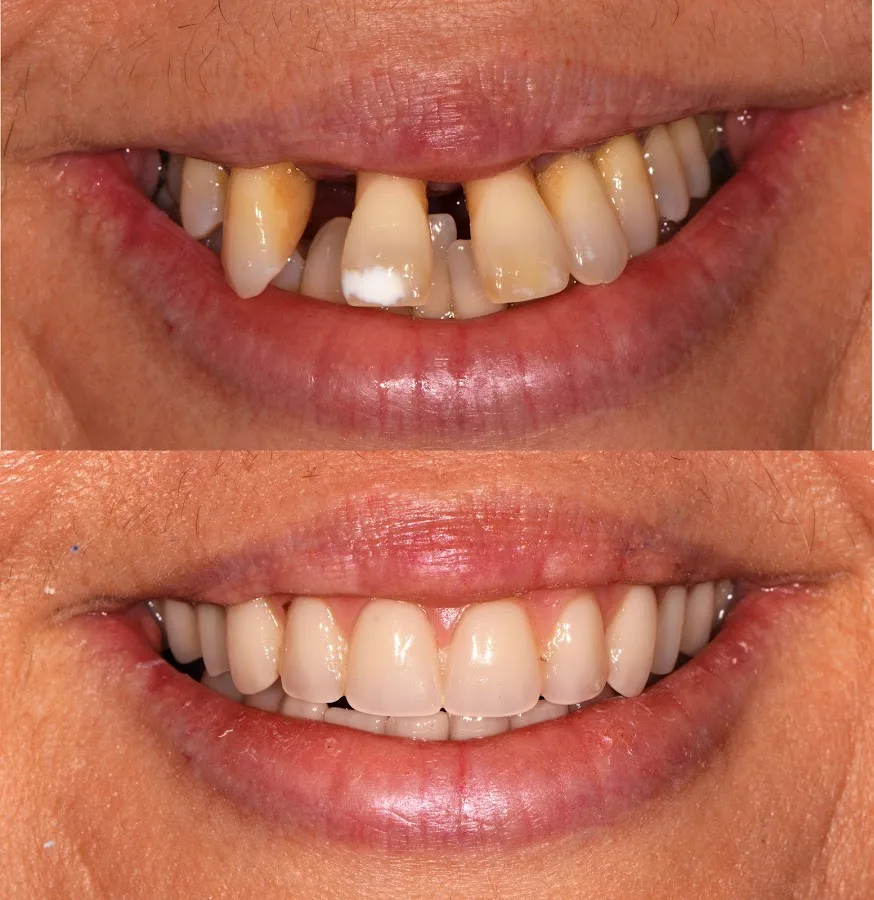 Hawaii Cosmetic Dental : Bogdan C. Rosala DDS PhD — photo 4