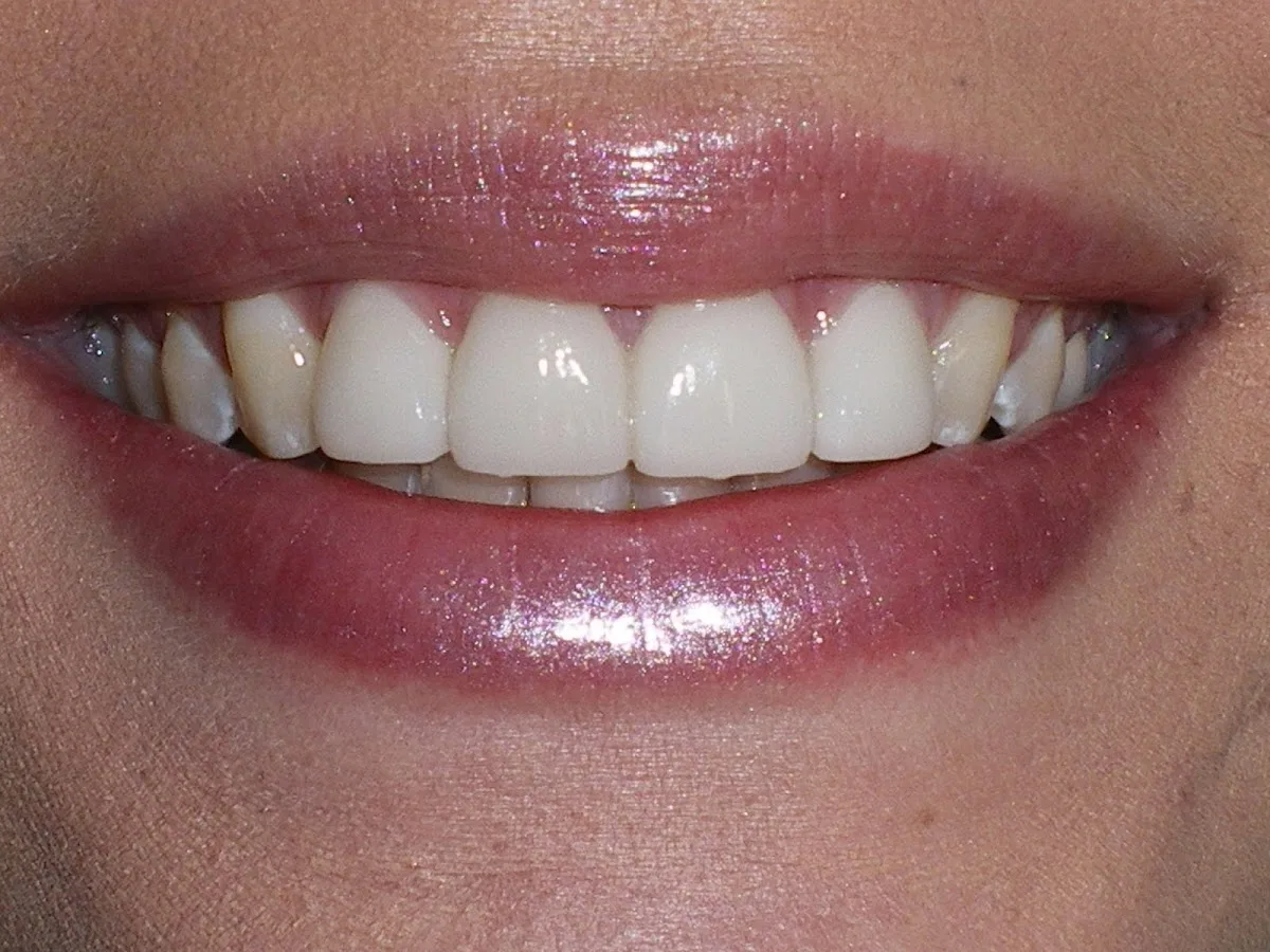 Healthy Smiles of Birmingham — photo 2