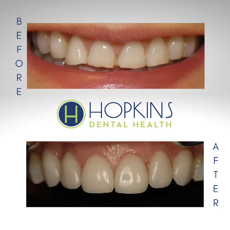 Hopkins Dental Health: Cosmetic Dentistry
