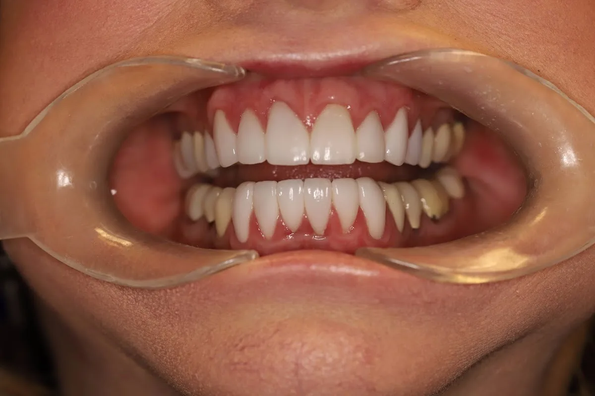 Huntsville Dental — photo 2