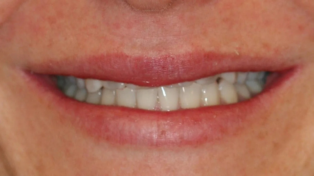 Kimberley Lane Cosmetic and Family Dentistry — photo 3