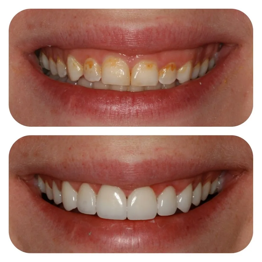 Lasting Smiles Dental Implant Center — photo 2